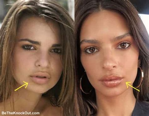 emily ratajkowski lips|Emily Ratajkowski Responds to Rumor She Got Lip Injections。